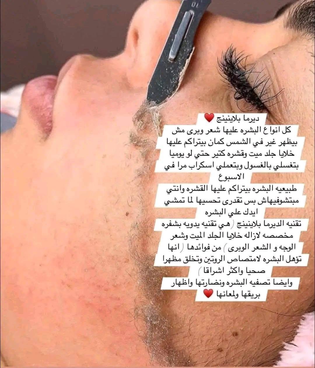 لكل اللي متعرفش الديرما بلانينج وواخده فكره غلط عنها 👇👇👇👇👇