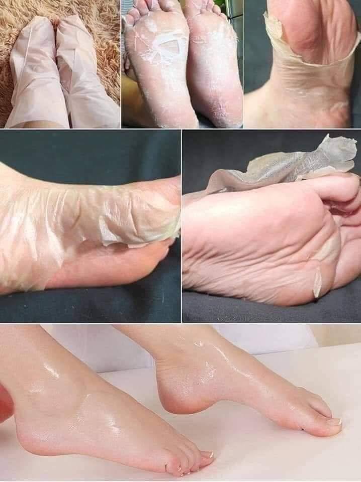 ماسك القدم الكوري  💜 صناعه كوري